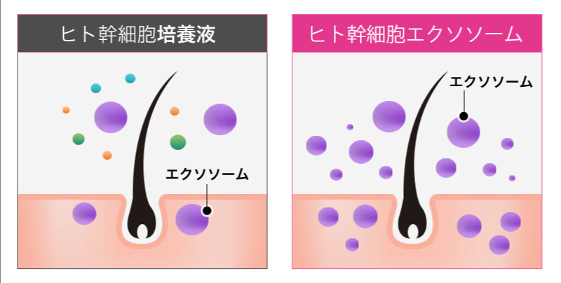 イメージ図